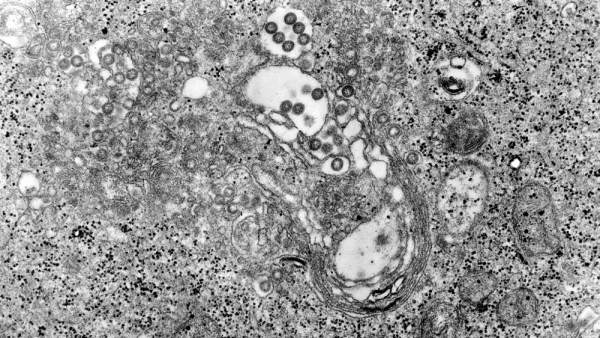 Virus SFTSV Virus SFTSV
