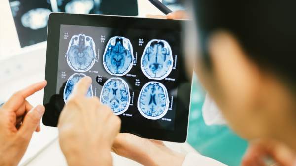 Cerebro Cerebro