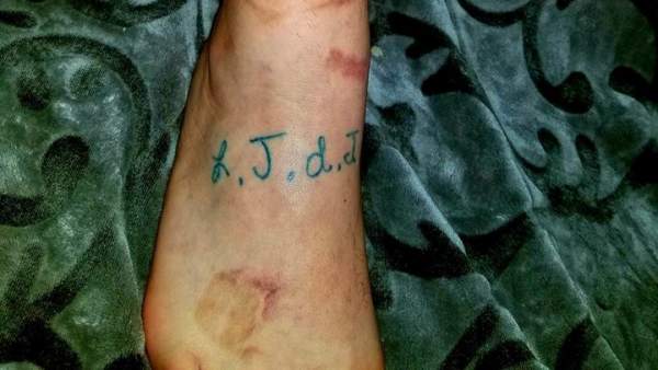 Se tatúa las cicatrices de su hijo Se tatúa las cicatrices de su hijo
