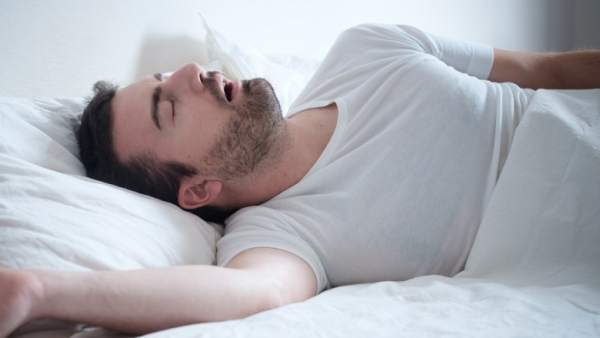 Apnea del sueño Apnea del sueño