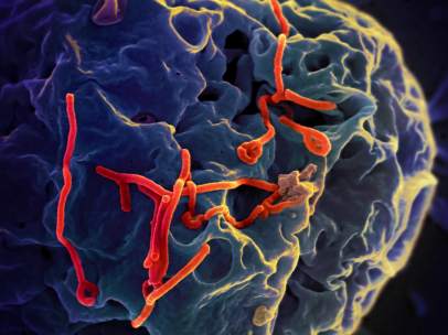 Virus del ébola.