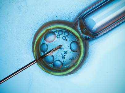 Fecundacion in vitro