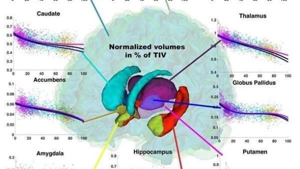 Estudio sobre el cerebro humano Estudio sobre el cerebro humano