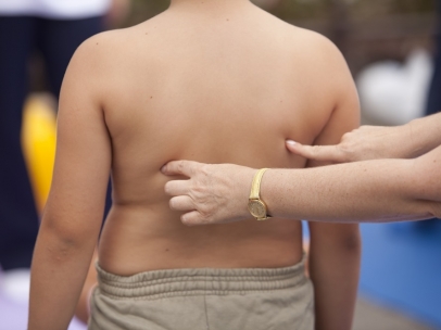 Obesidad infantil