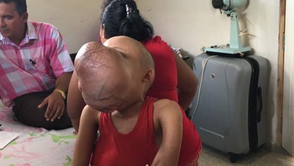 Tumor Tumor