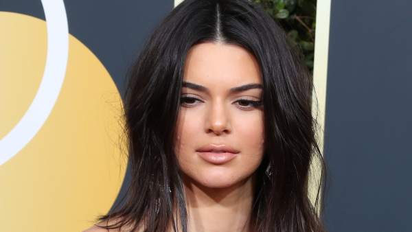 Resultado de imagen para kendall jenner acne