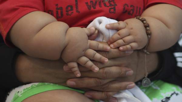 Niño obeso de ocho meses en Bogotá Niño obeso de ocho meses en Bogotá