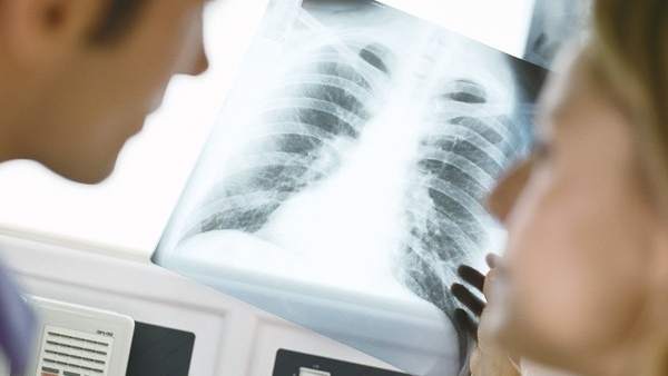 Médicos con radiografía Médicos con radiografía