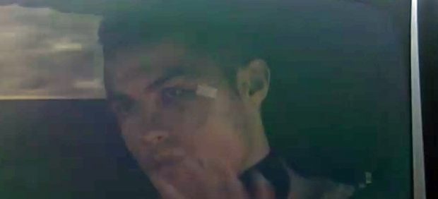 Cristiano Ronaldo, con el ojo morado