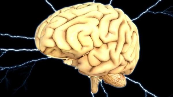 Cerebro, epilepsia Cerebro, epilepsia