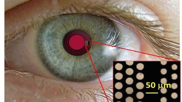 Dissenyen un nou implant intracorneal per a corregir la presbícia Dissenyen un nou implant intracorneal per a corregir la presbícia