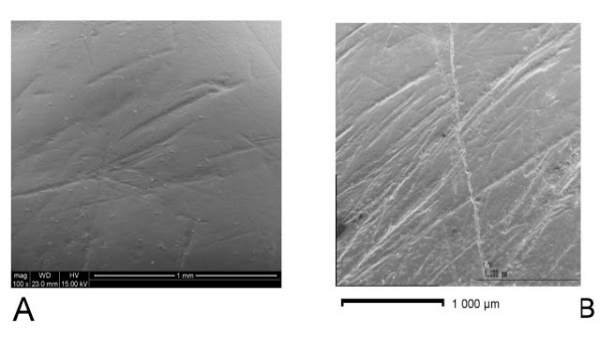 Marcas de dientes de un 'homo antecessor' y un preneandertal Marcas de dientes de un 'homo antecessor' y un preneandertal