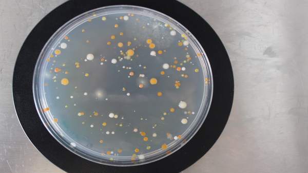 Comunidades microbianas Comunidades microbianas