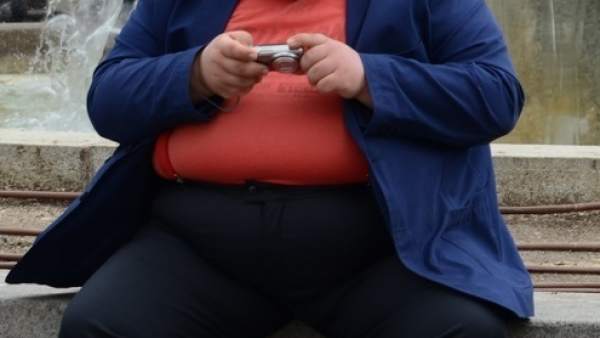 Obesidad Obesidad