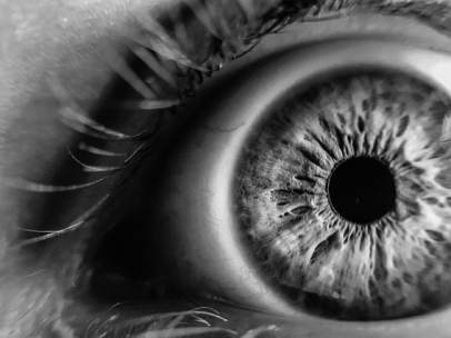 Ojo