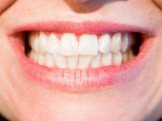 Dientes, bruxismo.