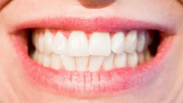 Dientes, bruxismo. Dientes, bruxismo.