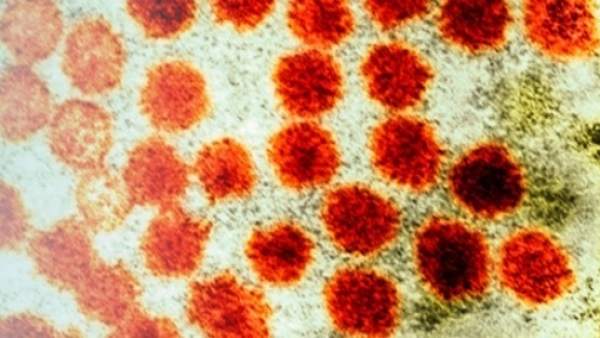 Hepatitis A Hepatitis A