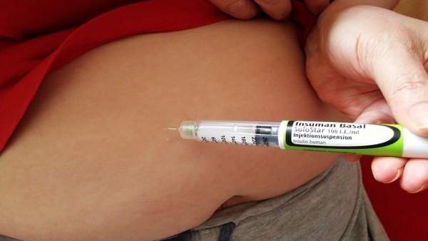 Obesidad y diabetes Obesidad y diabetes