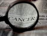 Inhabilitan 5 años a un médico por tratar el cáncer con métodos sin evidencia científica