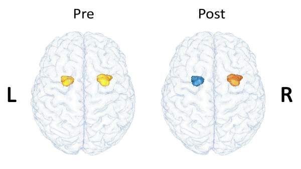 Terapia cognitiva Terapia cognitiva
