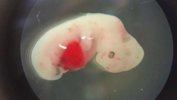 EmbriÃ³n de cerdo al que se le inyectaron cÃ©lulas humanas