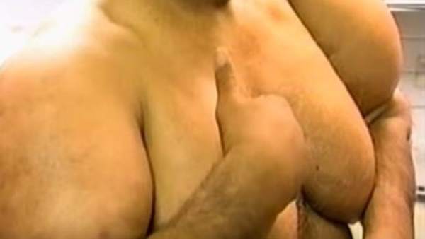 El extraño caso de un peruano cuyo cuerpo se hinchó después de bucear El extraño caso de un peruano cuyo cuerpo se hinchó después de bucear