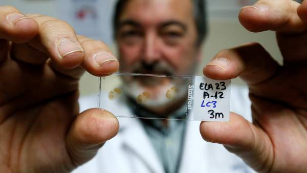 A medio millón de euros para un ensayo en humanos que frene la ELA
A medio millón de euros para un ensayo en humanos que frene la ELA