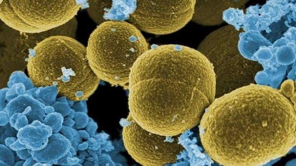 Staphylococcus aureus, bacteria Staphylococcus aureus, bacteria