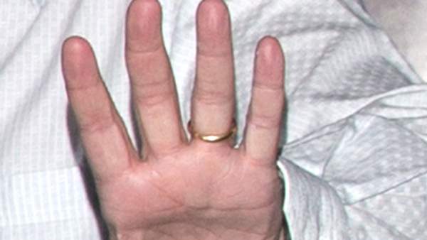 Anillo Anillo