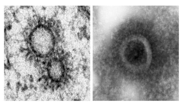 Virus gripe Virus gripe