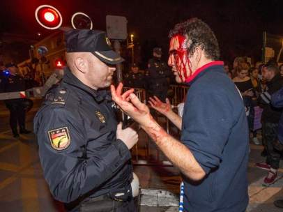 Herido en la manifestación del 8M en Murcia