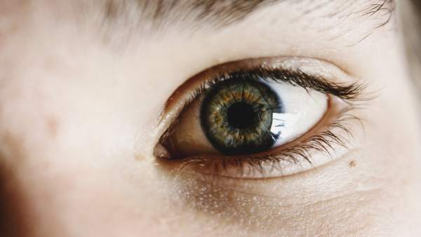 Glaucoma Glaucoma