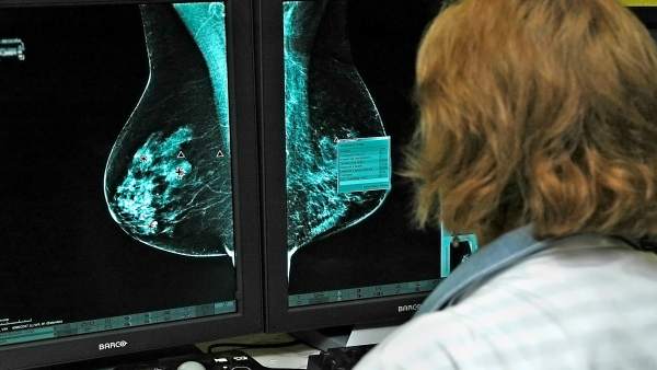 Oncólogos estudian nuevos medicamentos contra el cáncer de mama Oncólogos estudian nuevos medicamentos contra el cáncer de mama