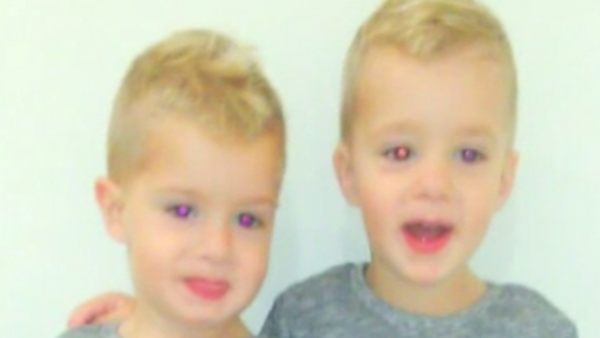 Dos gemelos con una enfermedad rara Dos gemelos con una enfermedad rara