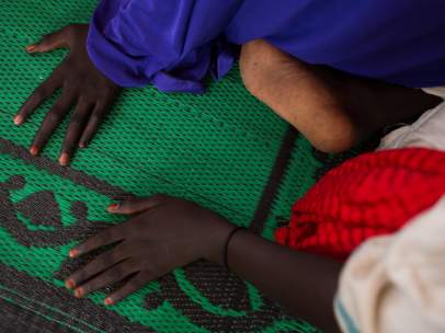 Niña afectada por el conflicto con Boko Haram.