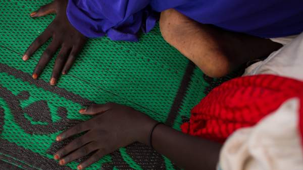Niña afectada por el conflicto con Boko Haram. Niña afectada por el conflicto con Boko Haram.
