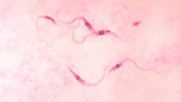 Chagas Chagas