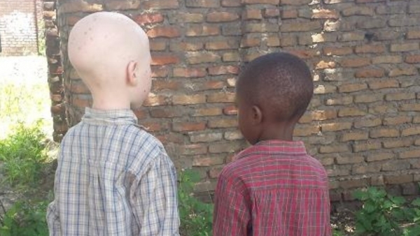 Albinos Albinos