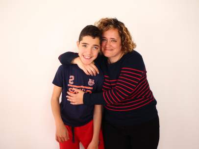 Parálisis cerebral