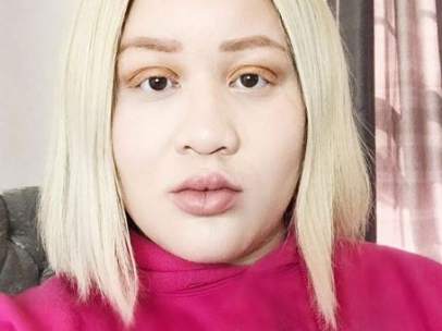 Modelo albina