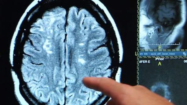 Radiografía del cerebro Radiografía del cerebro