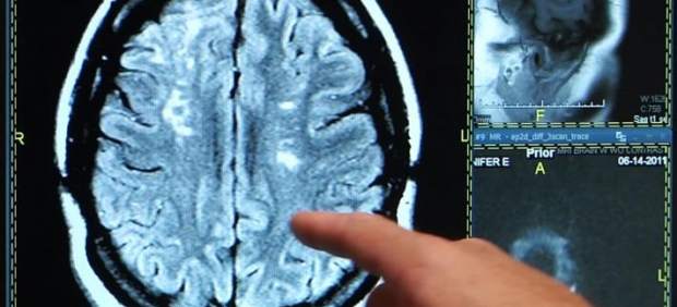 Radiografía del cerebro