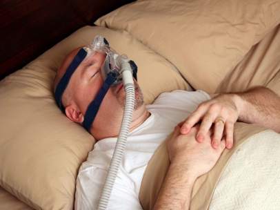APNEA DEL SUEÑO