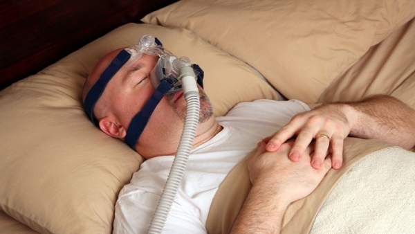 APNEA DEL SUEÑO APNEA DEL SUEÑO