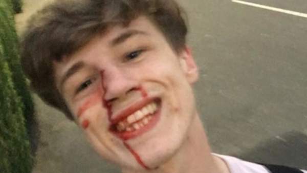 El joven agredido que ha compartido la foto en Facebook El joven agredido que ha compartido la foto en Facebook