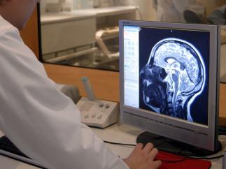 Resonancia magnética cerebro