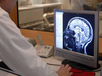 Resonancia magnética cerebro