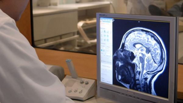 Resonancia magnética cerebro Resonancia magnética cerebro