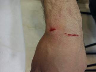 Heridas de la víctima